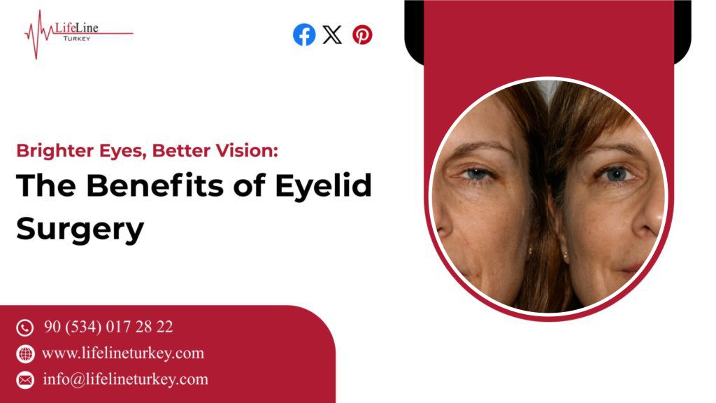 eyelid surgery in Turkey