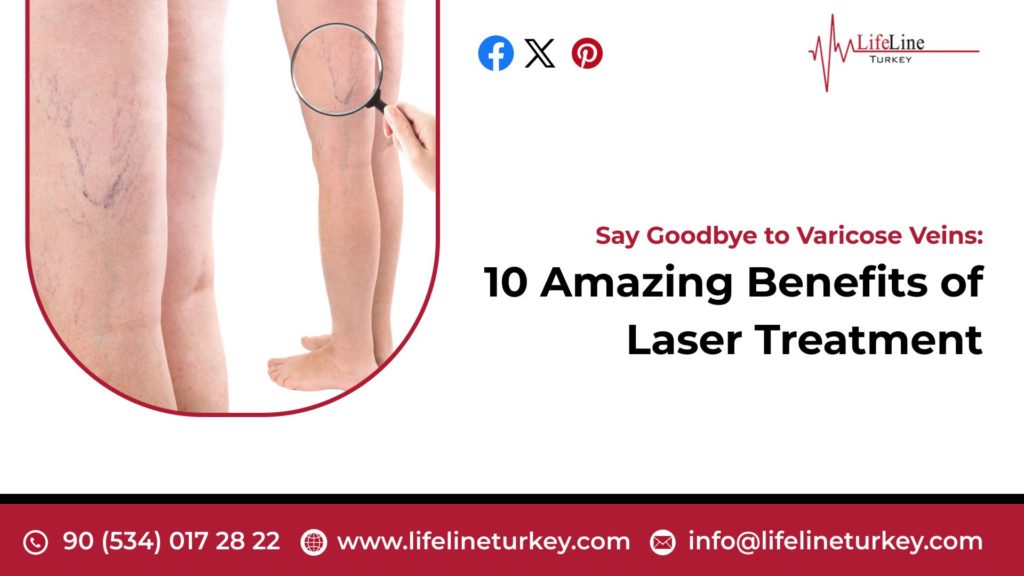 Varicose Vein Laser Treatment