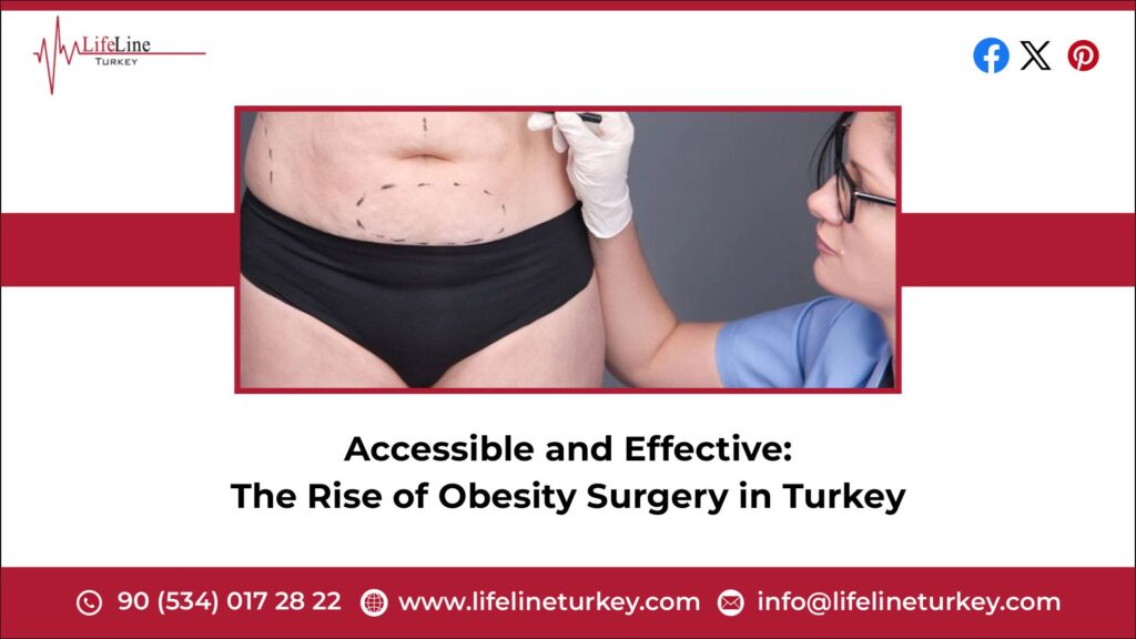 weight loss surgery in Turkey